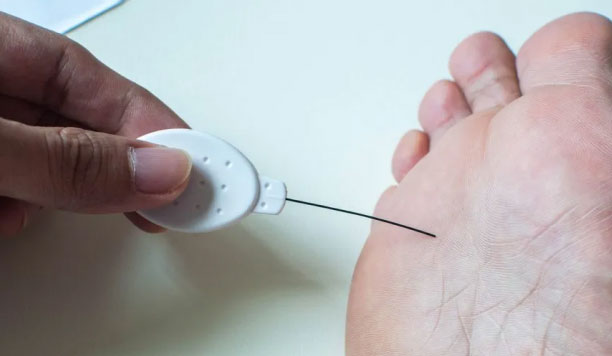 diabetic foot review